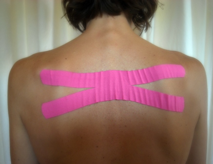 taping neurosensoriale